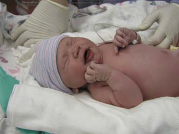 B Birth 17